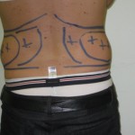 Love handles mapping