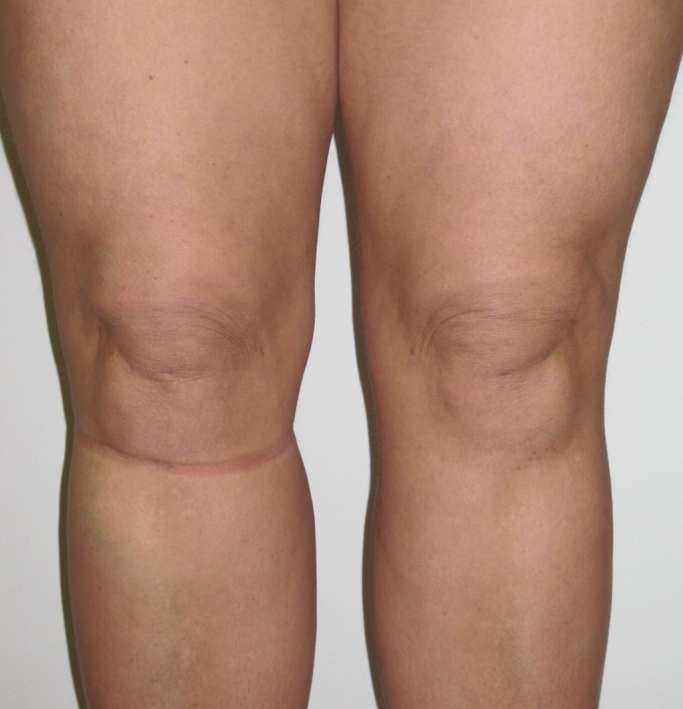 liposuction clinic central londonDrVidal.co.uk